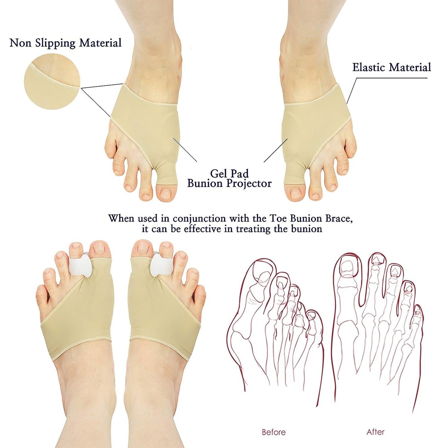 Bunion Finger Brace Toe Stretch Separation