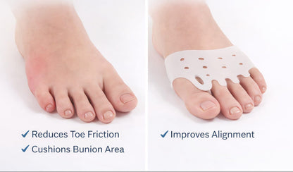 Bunion Finger Brace Toe Stretch Separation